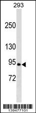 RALGDS Antibody