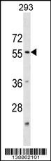 KATNA1 Antibody