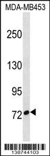 CUX1 Antibody