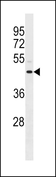 ANXA8L1/ANXA8L2 Antibody