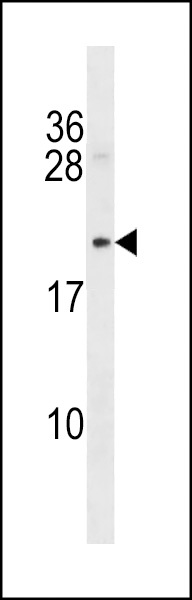 Mycb Antibody