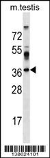 SURF4 Antibody