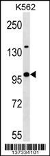 KLHL4 Antibody