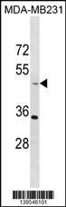 TAPBP Antibody