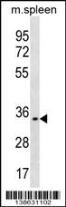 TREML1 Antibody