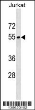 SEPT6 Antibody