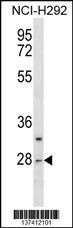 CTRL Antibody