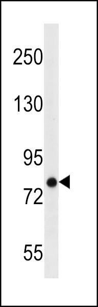 ARHGEF4 Antibody