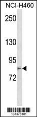 MCTP2 Antibody