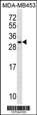 MRPS10 Antibody