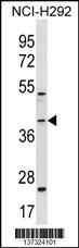 GIPC2 Antibody