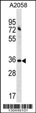 ACBD6 Antibody