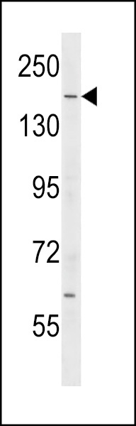 IQGAP2 Antibody