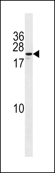 ZNF580 Antibody