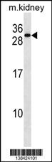 REEP5 Antibody