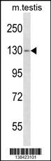 TBC1D2 Antibody