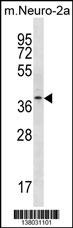 THOC6 Antibody