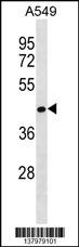 RCOR2 Antibody