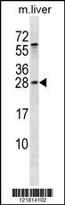 RAB5B Antibody