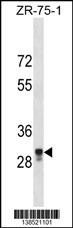 MPPED2 Antibody
