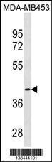 CCBL1 Antibody