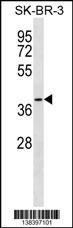 SFXN3 Antibody