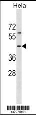 RBM41 Antibody