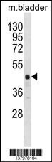 RBM41 Antibody