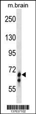 GLB1L Antibody