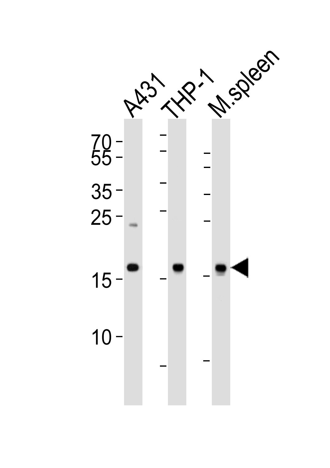 SNX3 Antibody