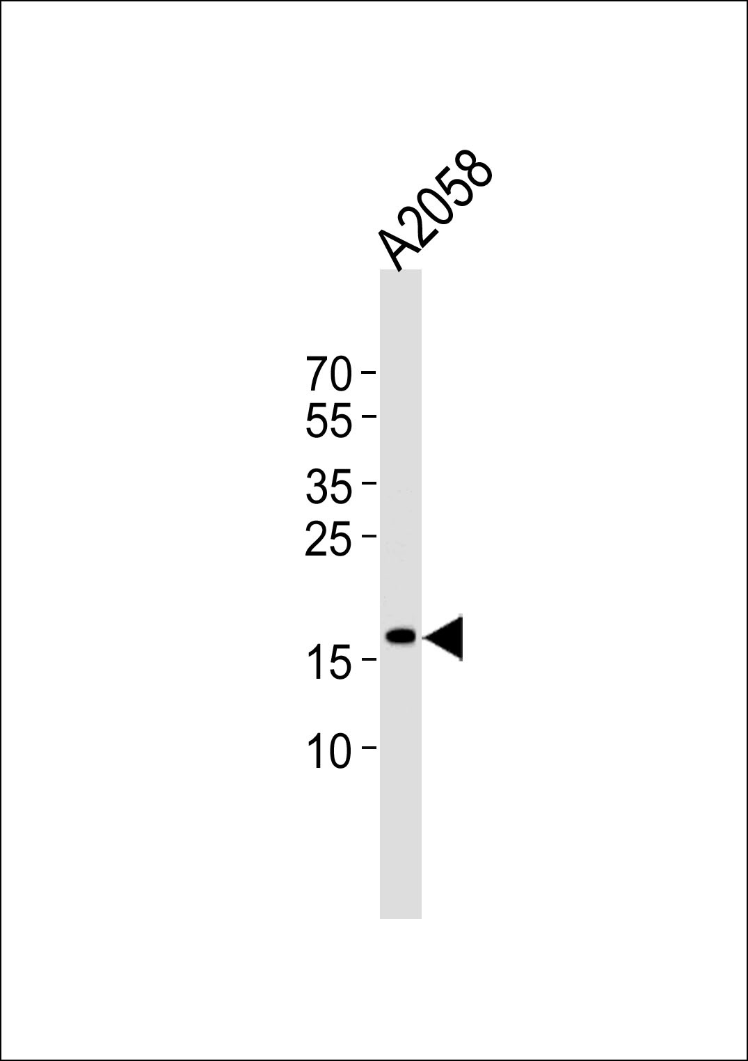 SNX3 Antibody