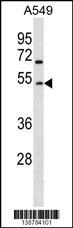 GCNT2 Antibody