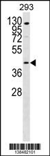 SLC52A1 Antibody