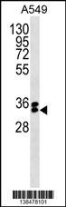 FBXO44 Antibody