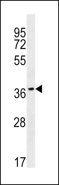 RAB36 Antibody