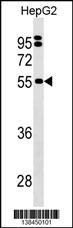 SEPSECS Antibody