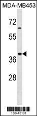Hoxa9 Antibody