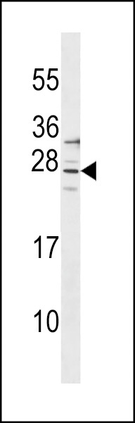 SIRPD Antibody