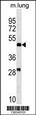 RNF150 Antibody