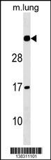 NAA60 Antibody