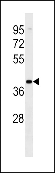 VN1R2 Antibody