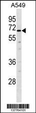 TULP2 Antibody