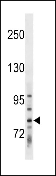 TBCK Antibody