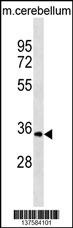 UCK1 Antibody