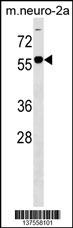 B4GALNT1 Antibody