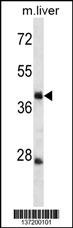 TRIM44 Antibody