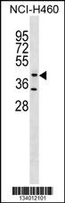 GLT8D1 Antibody