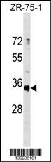 OR51G1 Antibody