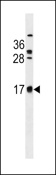 C2orf83 Antibody