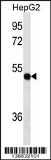 TXNDC5 Antibody
